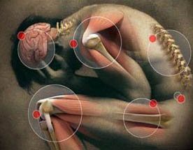 Ízületi gyulladásra (arthritis)